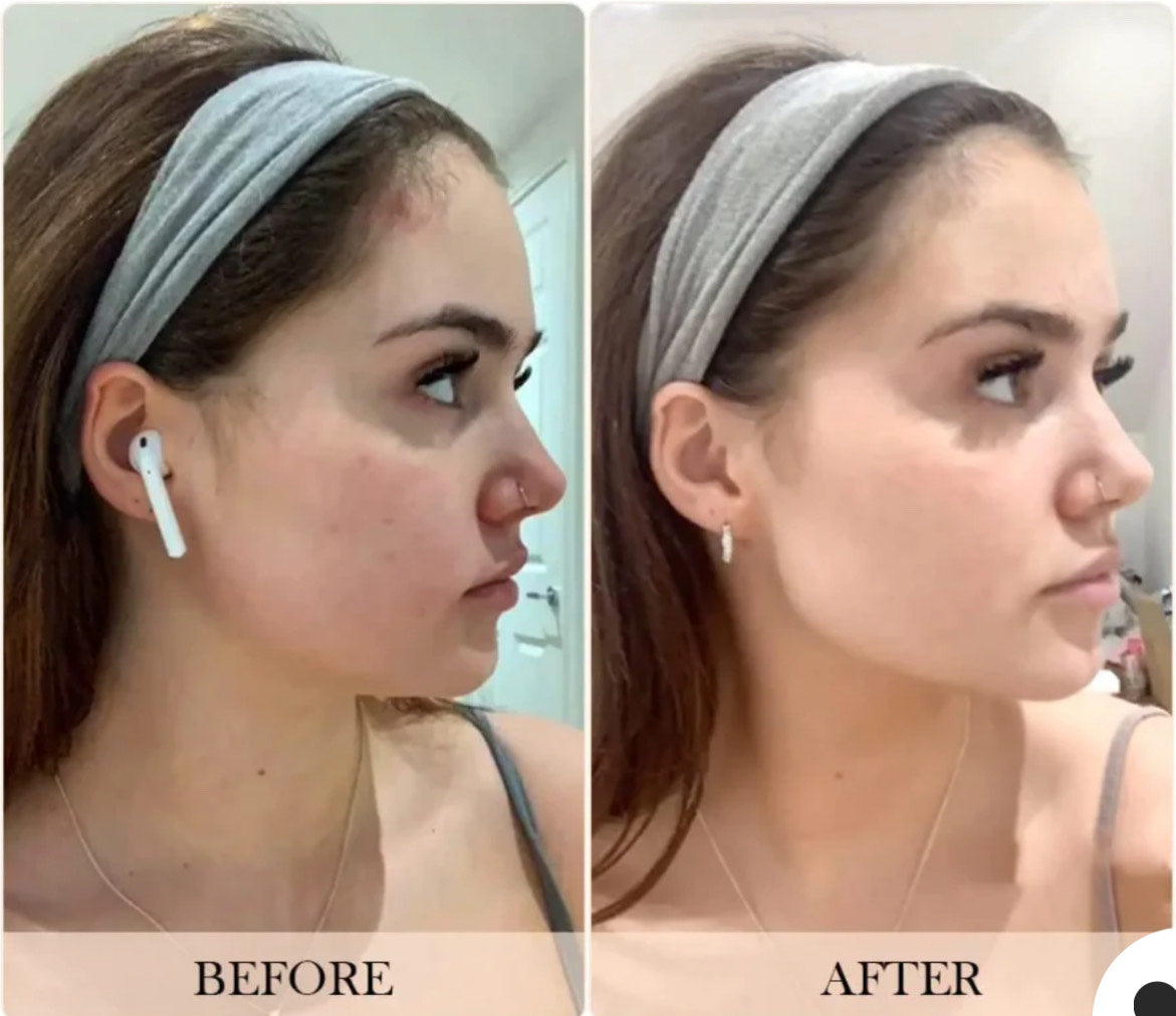 Electric Guasha Massager